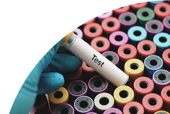 Sexual Health Screening Tests